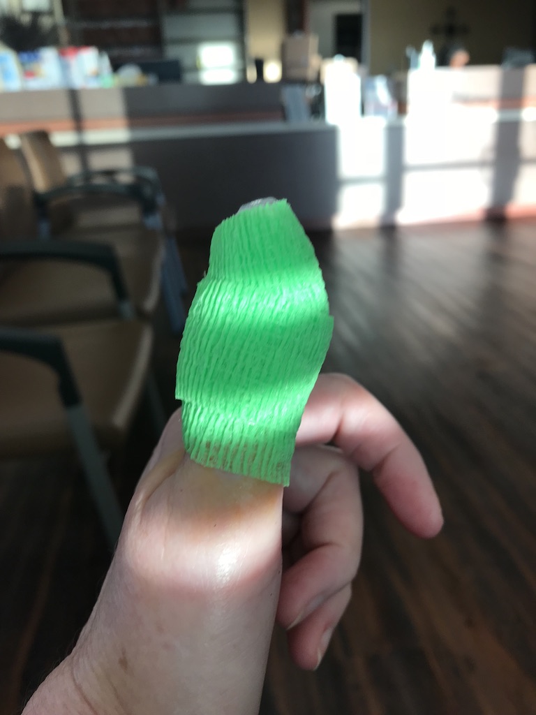 It’s Tough having a Bum&nbsp;Thumb